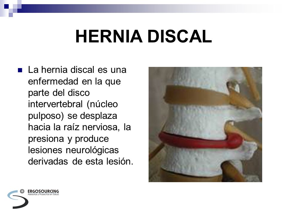 receta casera para quemar la grasa del estomago receta casera para quemar la grasa del estomago