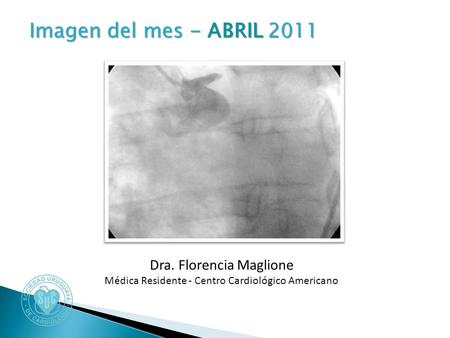 Imagen del mes - ABRIL 2011 Imagen del mes - ABRIL 2011 Dra. Florencia Maglione Médica Residente - Centro Cardiológico Americano.