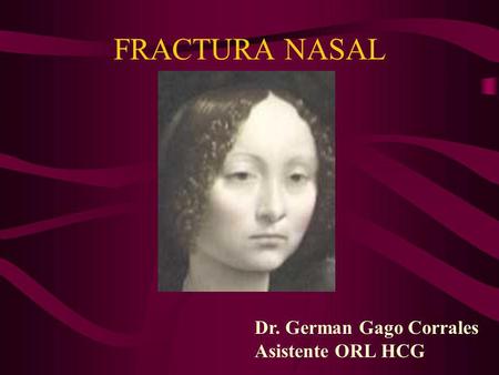 FRACTURA NASAL Dr. German Gago Corrales Asistente ORL HCG Ginevra