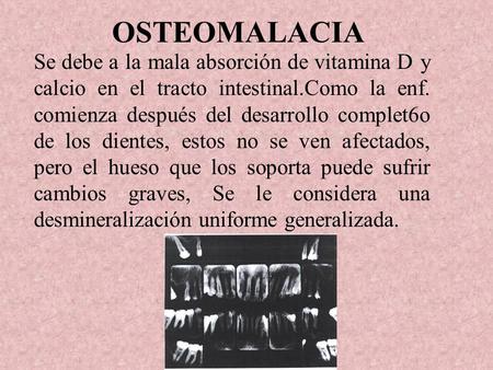 OSTEOMALACIA Se debe a la mala absorción de vitamina D y calcio en el tracto intestinal.Como la enf. comienza después del desarrollo complet6o de los dientes,