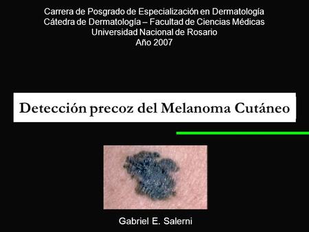 Detección precoz del Melanoma Cutáneo