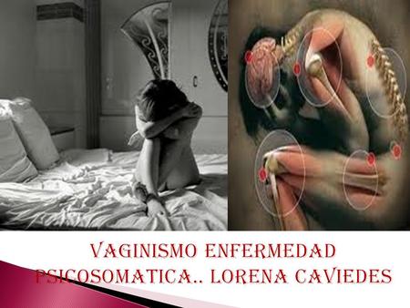 VAGINISMO ENFERMEDAD PSICOSOMATICA.. LORENA CAVIEDES