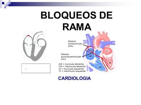BLOQUEOS DE RAMA CARDIOLOGIA.