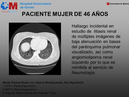 PACIENTE MUJER DE 46 AÑOS Hallazgo incidental en estudio de litiasis renal de múltiples imágenes de baja atenuación en bases del parénquima pulmonar visualizado,