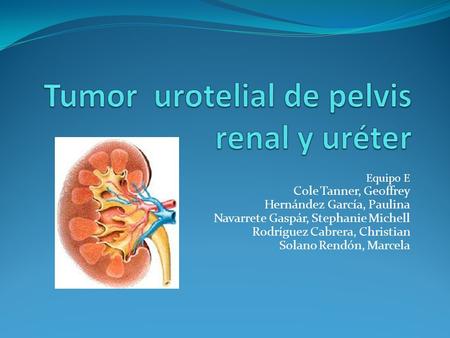 Tumor urotelial de pelvis renal y uréter