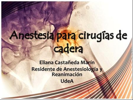 Eliana Castañeda Marín Residente de Anestesiología y Reanimación UdeA
