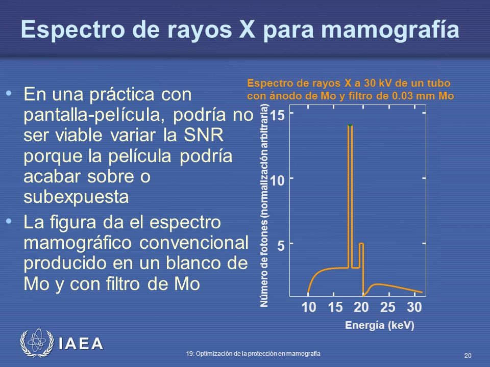 Que es la energia de fotones en mamografia 92 Que es la energia de fotones en mamografia 65