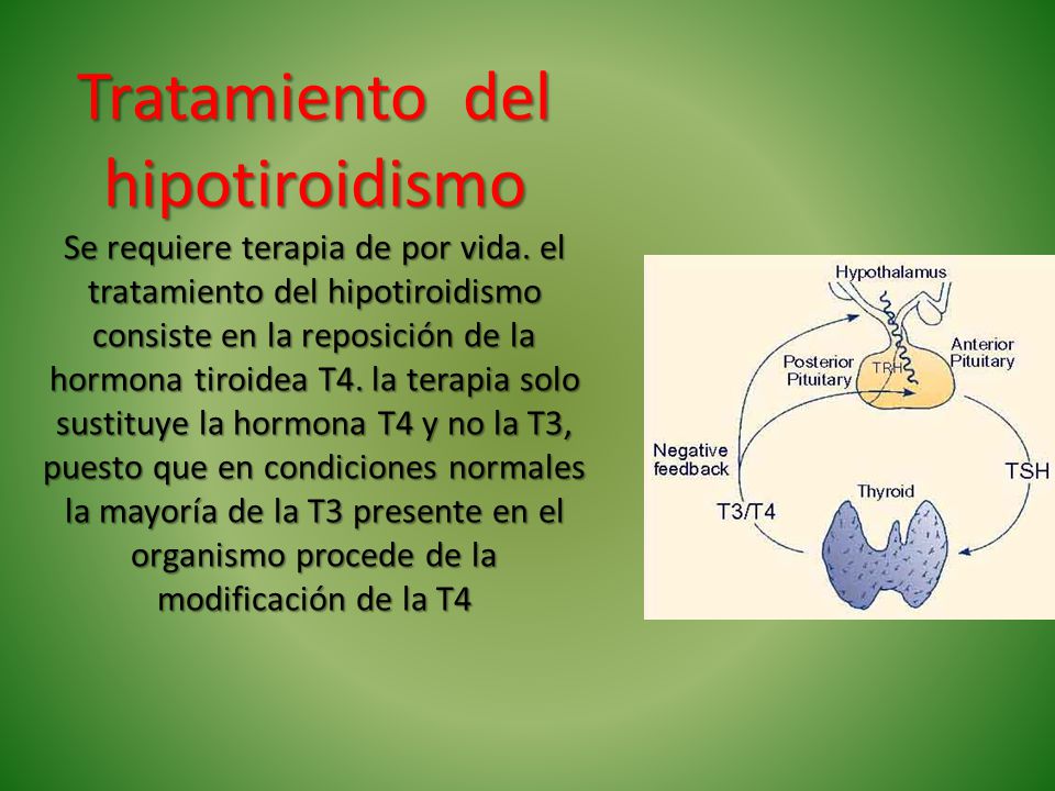 HIPOTIROIDISMO. - ppt descargar HIPOTIROIDISMO. - ppt descargar
