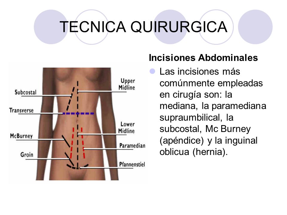 MANEJO Y CUIDADOS DE DRENAJES