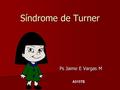 Síndrome de Turner Ps Jaime E Vargas M A515TE.