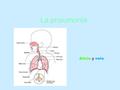 La pneumonia Alicia y nela. La neumonía es una enfermedad del sistema respiratorio que consiste en la inflamación de los espacios alveolares de los pulmones.