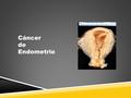 Cáncer de Endometrio. Tumor maligno que se origina en la mucosa endometrial que reviste la cavidad del cuerpo del útero por encima del límite superior.