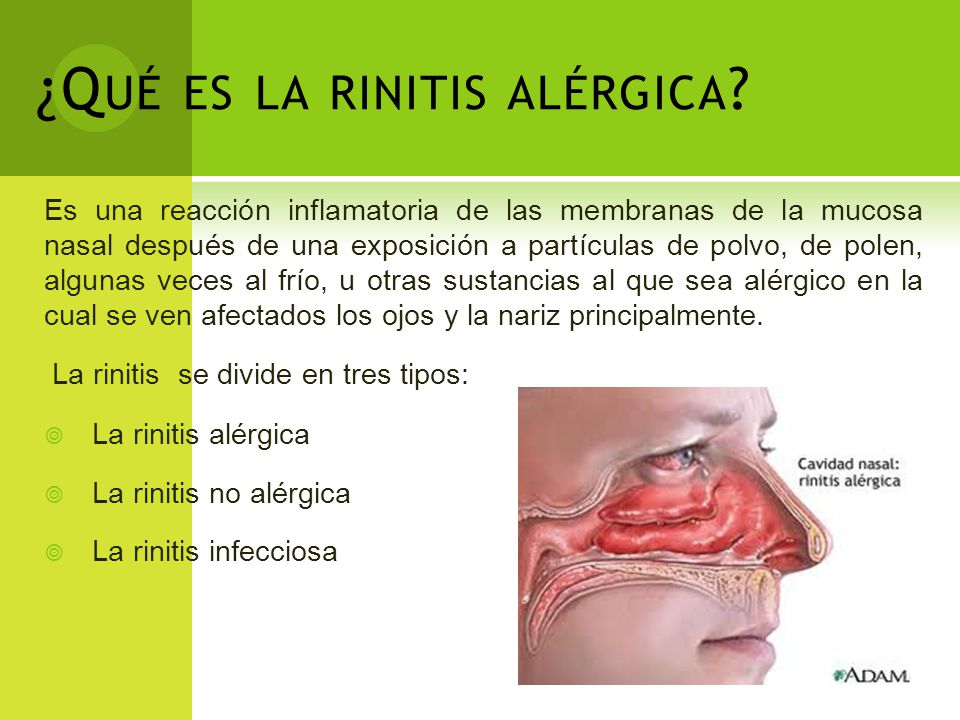 Dra. Karen Suñé Fecha: 8 de Noviembre ppt descargar Dra. Karen Suñé Fecha: 8 de Noviembre ppt descargar