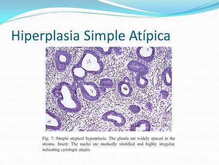 Hiperplasia Simple Atípica