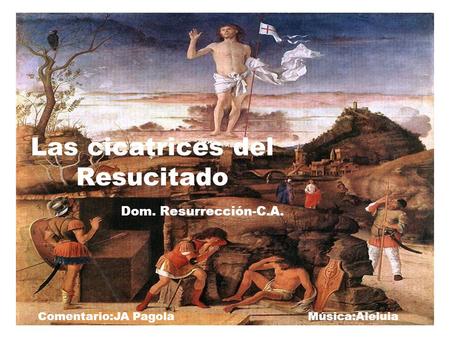 Las cicatrices del Resucitado Dom. Resurrección-C.A. Comentario:JA Pagola Música:Aleluia.