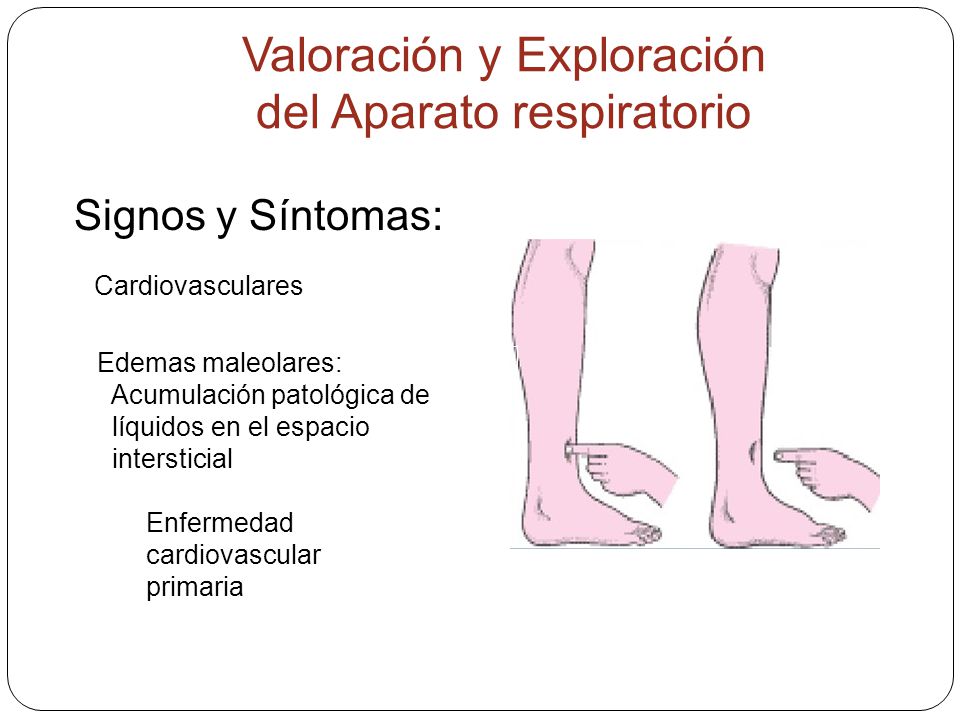 VALORACION RESPIRATORIA - ppt descargar VALORACION RESPIRATORIA - ppt descargar