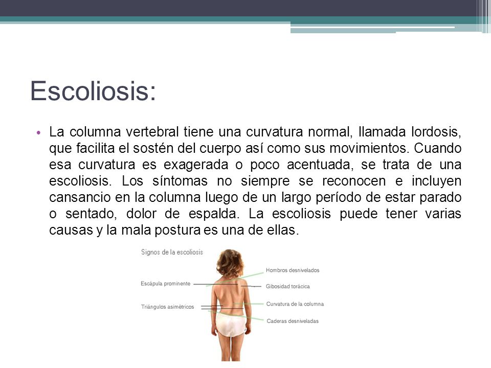 La escoliosis 2 fotos