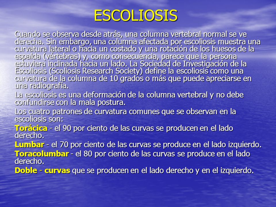 Si es posible sanar la escoliosis después de 30