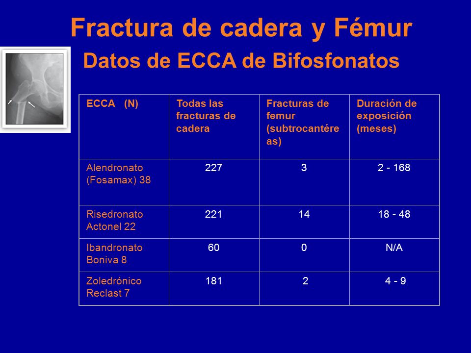 Boniva Vs Fosamax Vs Actonel