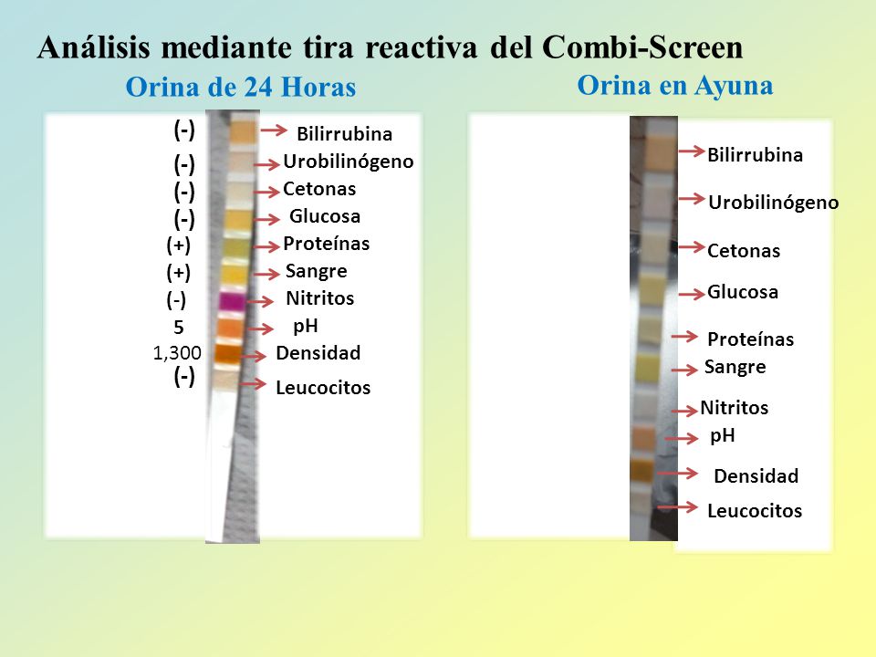 ANÁLISIS FISICOQUÍMICO DE LA ORINA - ppt video online ANÁLISIS FISICOQUÍMICO DE LA ORINA - ppt video online