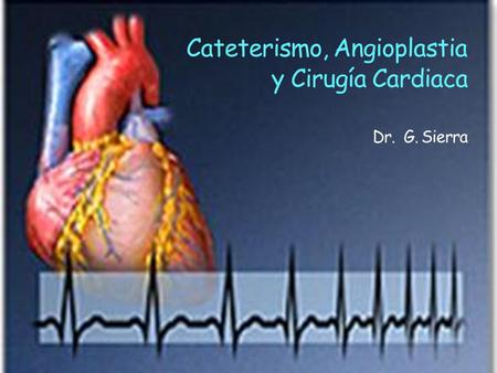 Cateterismo, Angioplastia y Cirugía Cardiaca Dr. G. Sierra