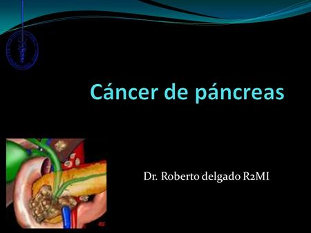 Cáncer de páncreas Dr. Roberto delgado R2MI.