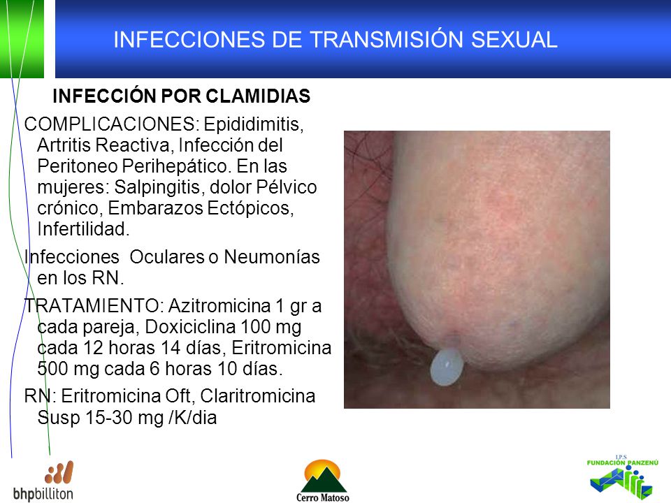 Infecciones Sexsuales 109