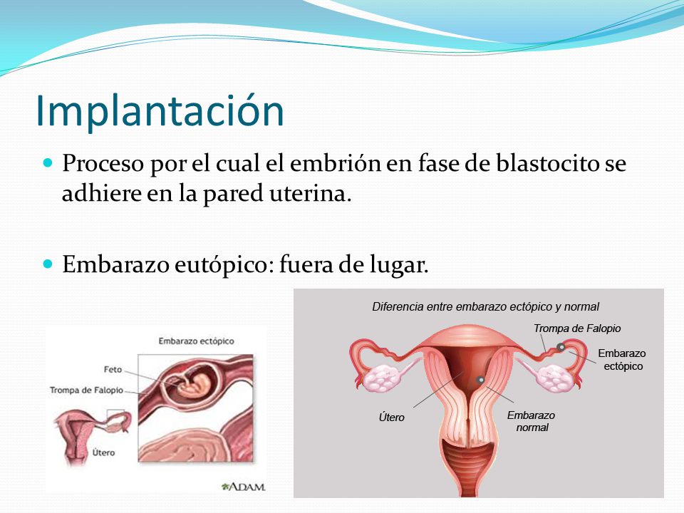 Resultado de imagen para implantación