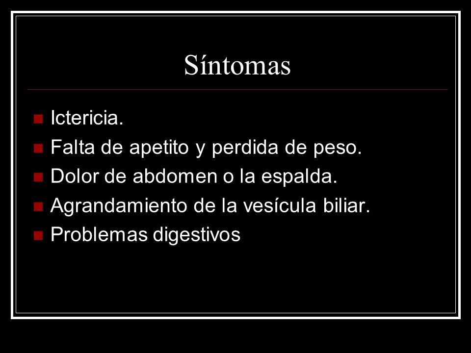 como perder grasa y definirse de manera inteligente Como perder grasa y definirse de manera inteligente tcnica