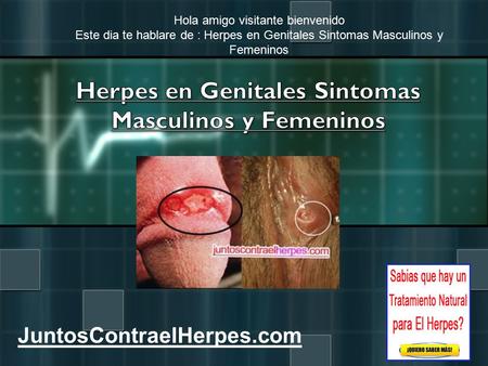 JuntosContraelHerpes.com Hola amigo visitante bienvenido Este dia te hablare de : Herpes en Genitales Sintomas Masculinos y Femeninos.