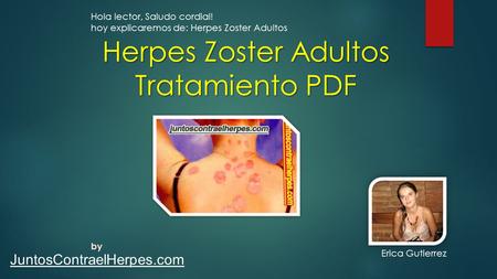 Herpes Zoster Adultos Tratamiento PDF JuntosContraelHerpes.com Hola lector, Saludo cordial! hoy explicaremos de: Herpes Zoster Adultos by Erica Gutierrez.