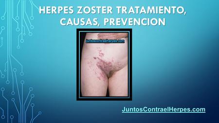 HERPES ZOSTER TRATAMIENTO, CAUSAS, PREVENCION JuntosContraelHerpes.com.