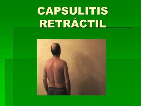 CAPSULITIS RETRÁCTIL.