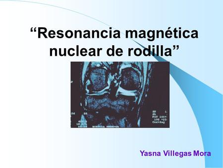 “Resonancia magnética nuclear de rodilla”