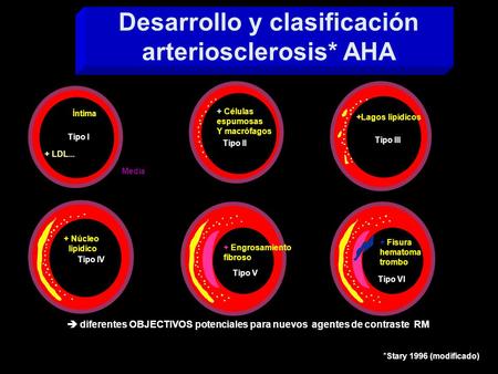Desarrollo y clasificación arteriosclerosis* AHA