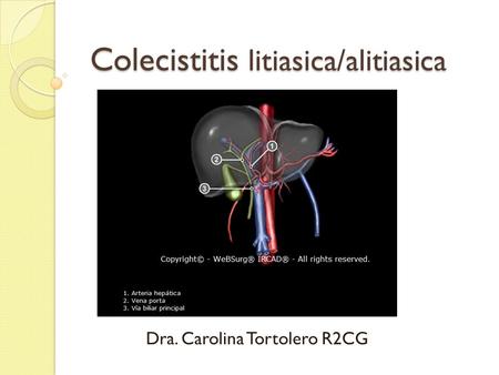 Colecistitis litiasica/alitiasica