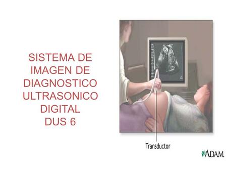 SISTEMA DE IMAGEN DE DIAGNOSTICO ULTRASONICO DIGITAL DUS 6.