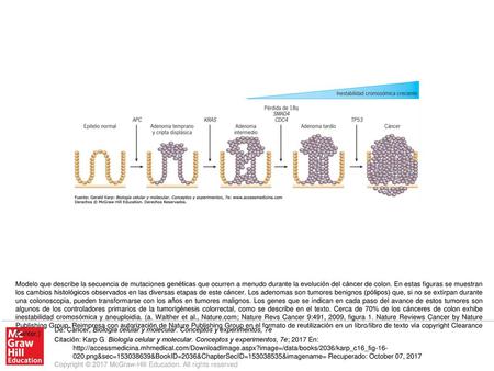 Modelo que describe la secuencia de mutaciones genéticas que ocurren a menudo durante la evolución del cáncer de colon. En estas figuras se muestran los.