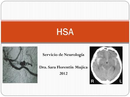 Servicio de Neurología Dra. Sara Florentín Mujica 2012