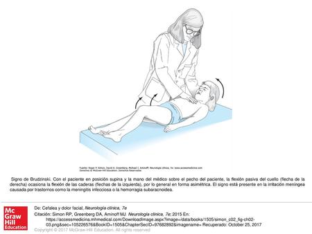 Signo de Brudzinski. Con el paciente en posición supina y la mano del médico sobre el pecho del paciente, la flexión pasiva del cuello (flecha de la derecha)