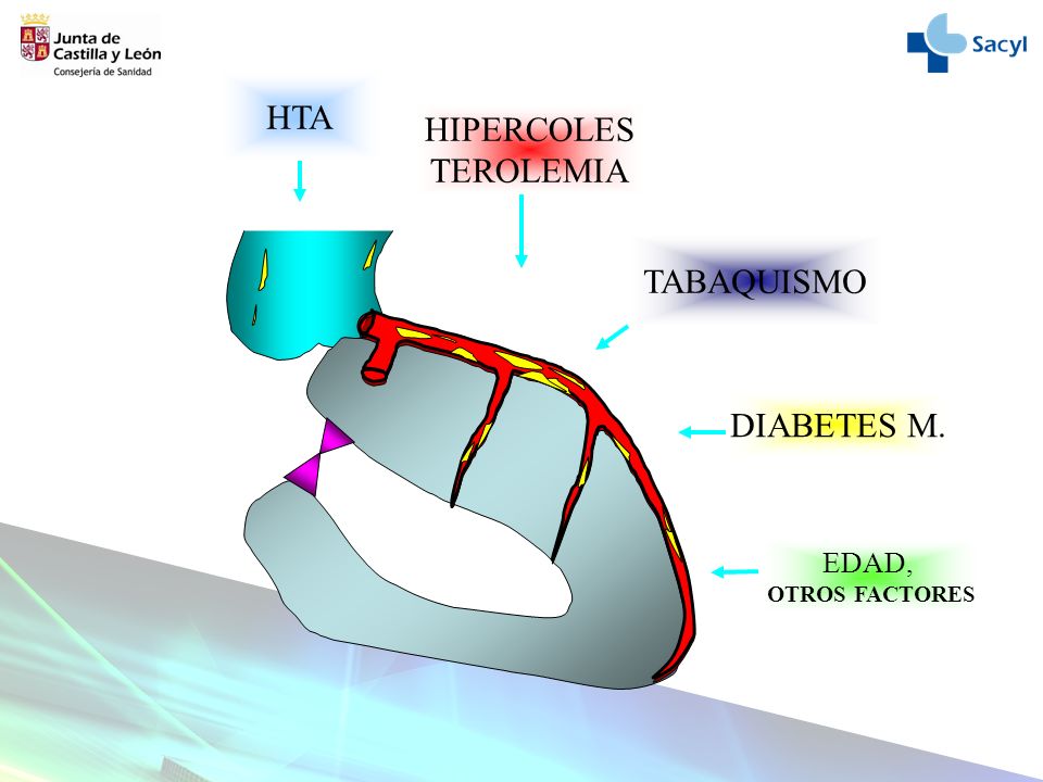 La Angina y el Infarto de Miocardio. - ppt descargar La Angina y el Infarto de Miocardio. - ppt descargar