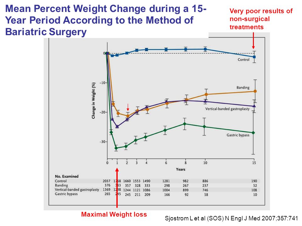Updated: 4/27/2017 2:17 PM. Mean Percent Weight Change during a 15-Year Period According to the Method of Bariatric Surgery.