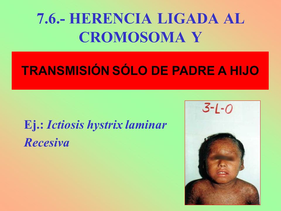 7.6.- HERENCIA LIGADA AL CROMOSOMA Y