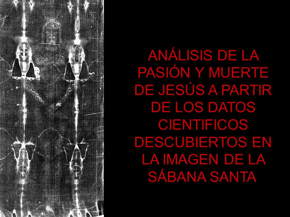 ANÁLISIS DE LA PASIÓN Y MUERTE DE JESÚS A PARTIR DE LOS DATOS CIENTIFICOS DESCUBIERTOS EN LA IMAGEN DE LA SÁBANA SANTA.
