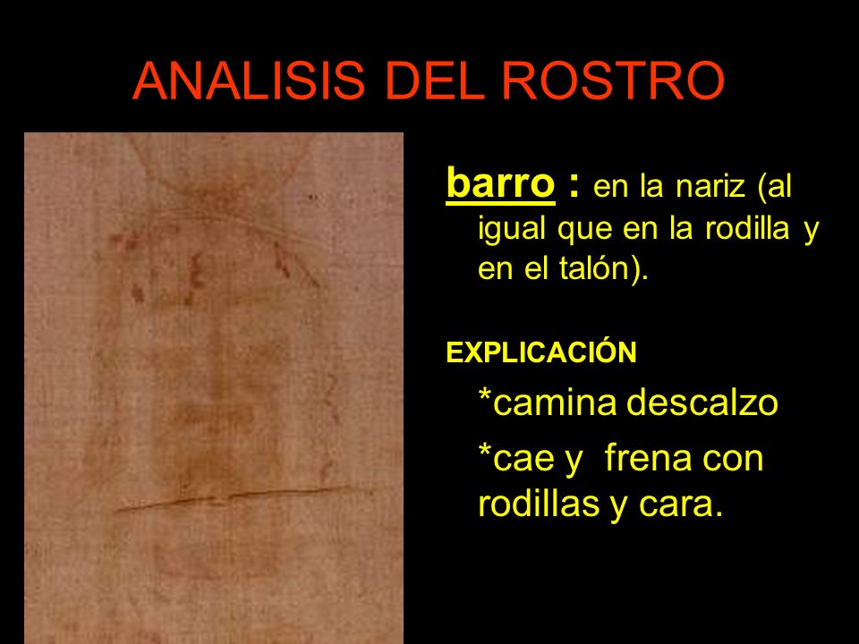 ANALISIS DEL ROSTRO barro : en la nariz (al igual que en la rodilla y en el talón). EXPLICACIÓN. *camina descalzo.