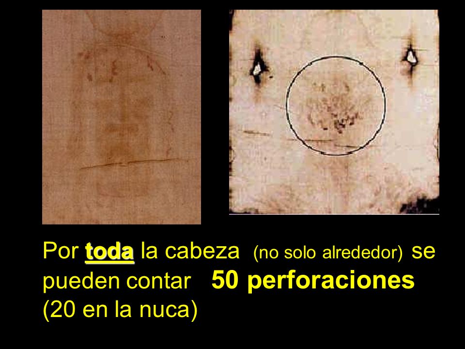 Por toda la cabeza (no solo alrededor) se pueden contar