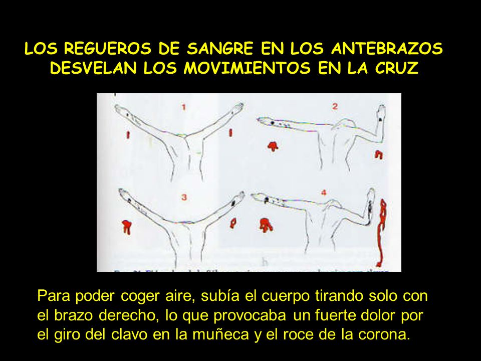 LOS REGUEROS DE SANGRE EN LOS ANTEBRAZOS DESVELAN LOS MOVIMIENTOS EN LA CRUZ