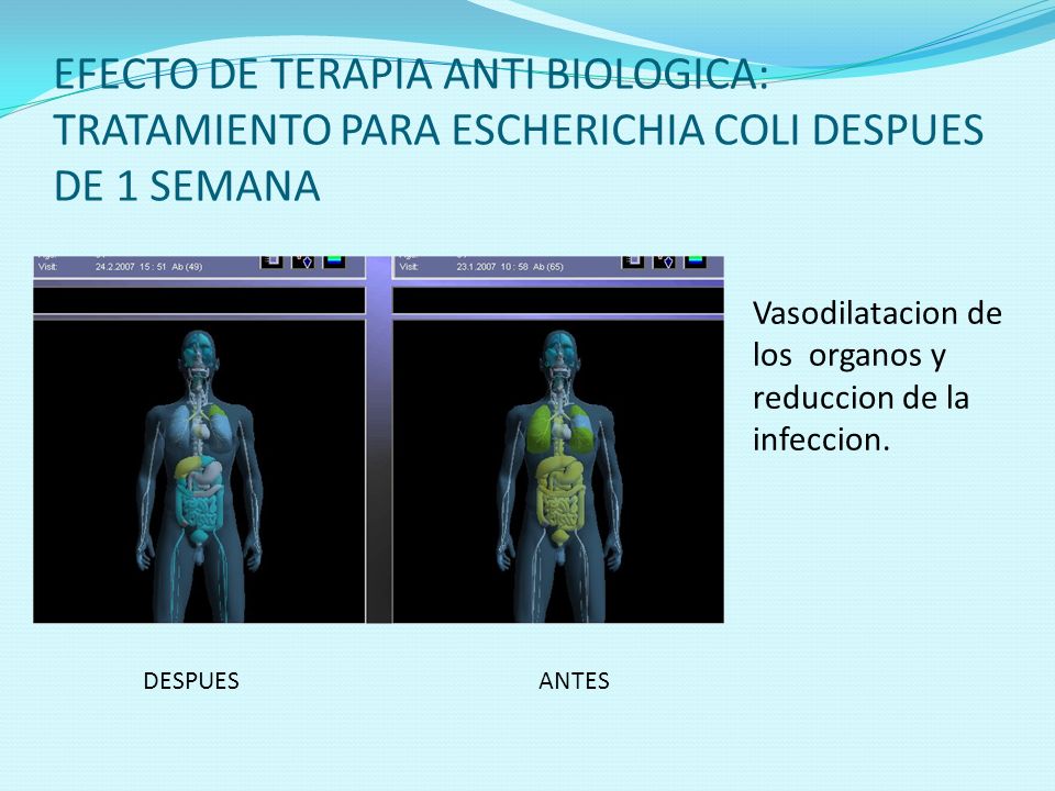 EFECTO DE TERAPIA ANTI BIOLOGICA: TRATAMIENTO PARA ESCHERICHIA COLI DESPUES DE 1 SEMANA