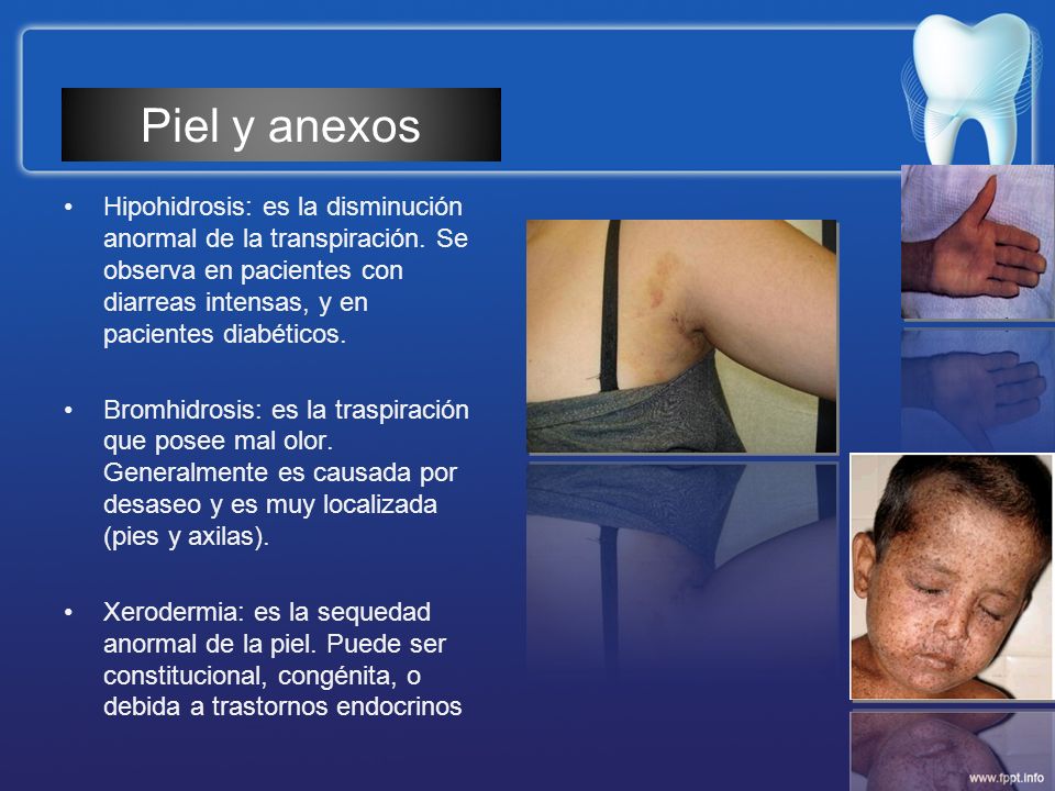 Piel y anexos Hipohidrosis: es la disminución anormal de la transpiración. Se observa en pacientes con diarreas intensas, y en pacientes diabéticos.