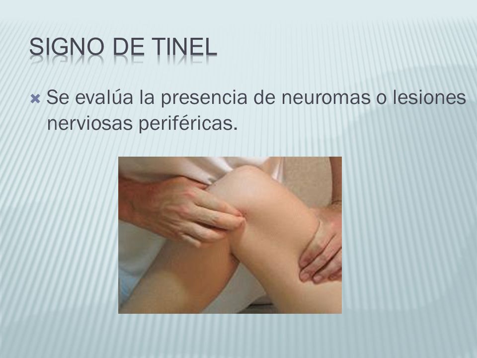 Signo de Tinel Se evalúa la presencia de neuromas o lesiones nerviosas periféricas.